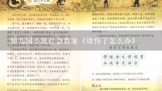 幼儿园小班社会教案《烫伤了怎么办》