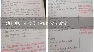 幼儿中班不咬伤不抓伤安全教案