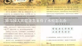 幼儿园大班健康教案得了水痘怎么办